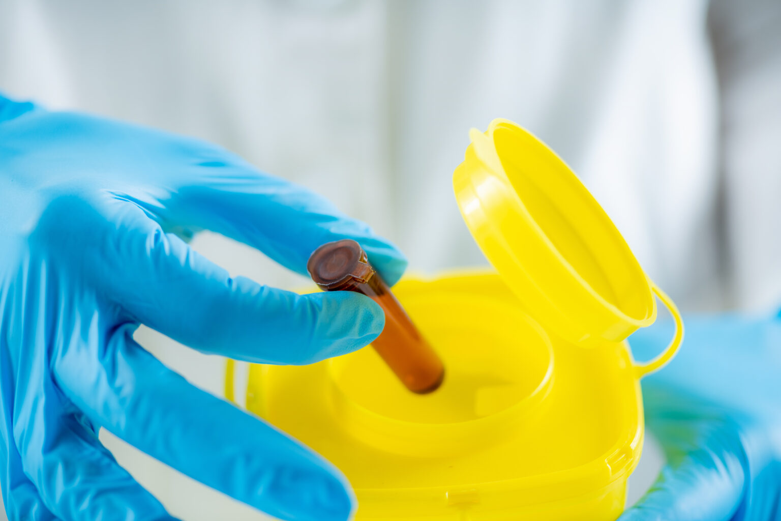 Buttersäure Wie du den Geruch entfernen und kannst